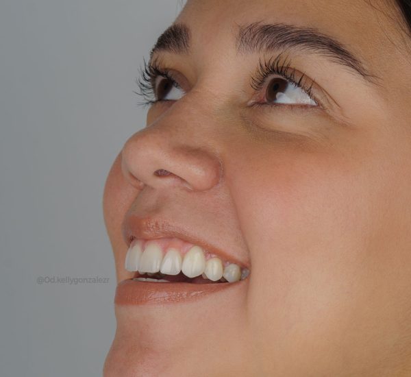 galeria-2